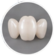 Zirkonium implantaatkroon